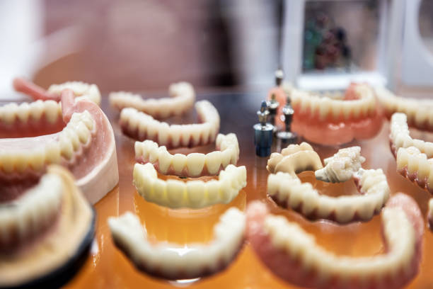 istock Samples with porcelain teeth and dental prosthesis 1315390749