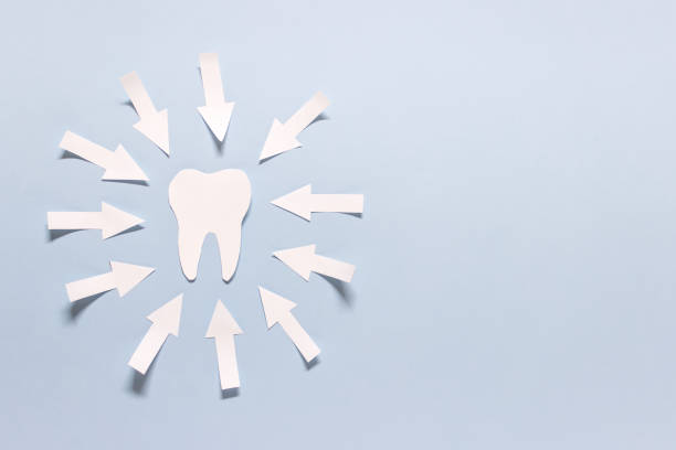 One tooth with many arrows on blue background stock photo