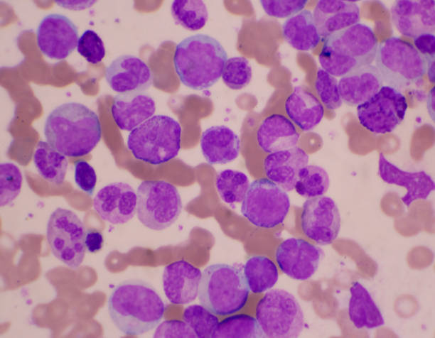 istock Mixed stage white blood cell on red cells background.Leukemia concept. 1315623152