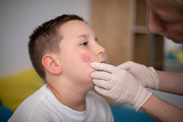 istock Mother cleaning her son's wound on his cheek 1315635655