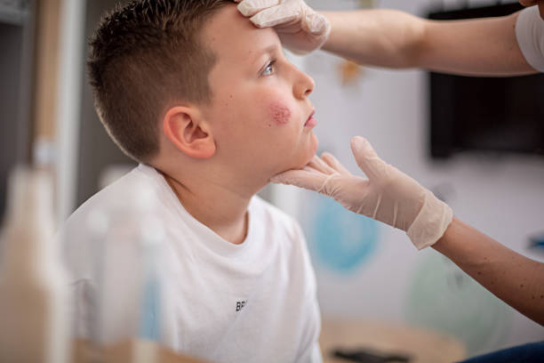 istock Mother cleaning her son's wound on his cheek 1315644107