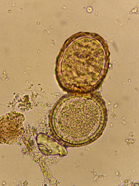 istock Egg of Ascaris lumbricoides (roundworm) in human stool 1315665216