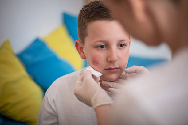 istock Mother cleaning her son's wound on his cheek 1315722520
