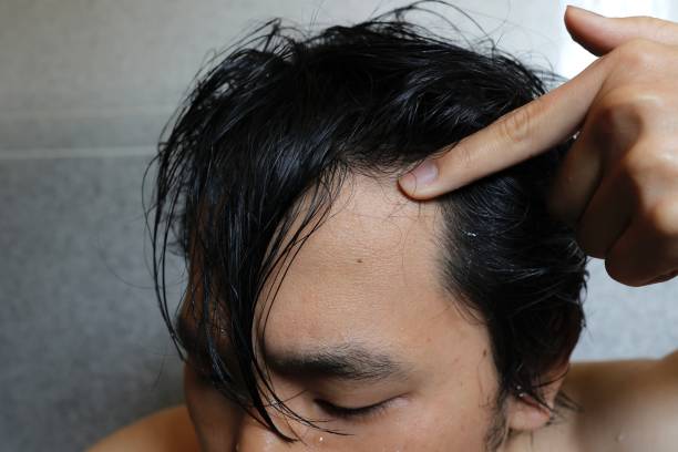 Japanese man with wide outskirts