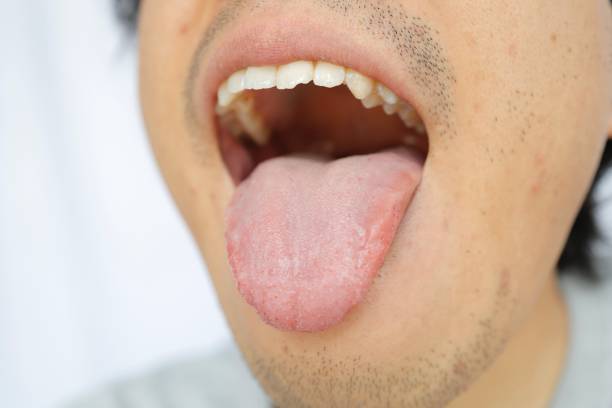 istock Japanese male tongue 1315787864