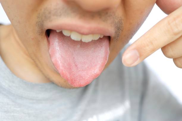 istock Japanese male tongue 1315787878