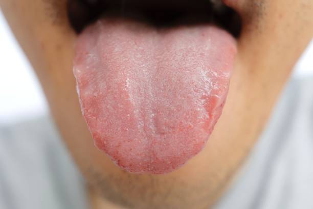 istock Japanese male tongue 1315787899