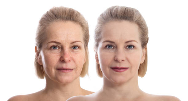 Woman's face before and after makeup. Middle aged woman. Woman's face before and after makeup. Close up botox before and after stock pictures, royalty-free photos & images
