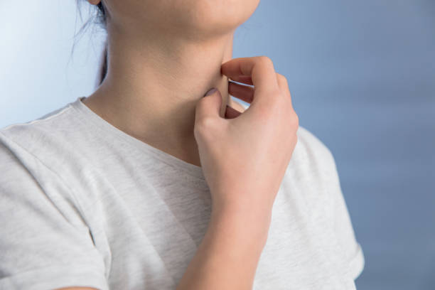 istock Woman with allergy symptoms scratching neck 1316030692