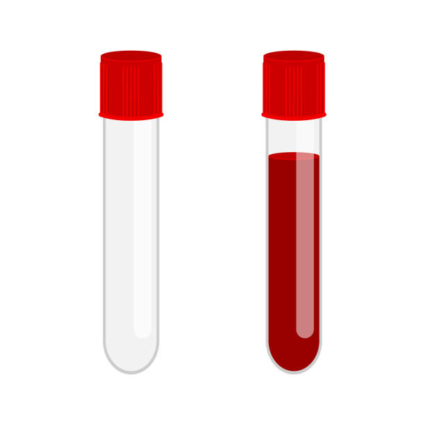 illustrazioni stock, clip art, cartoni animati e icone di tendenza di provetta di vetro vuota e piena di campione di sangue isolato su sfondo bianco. icona dell'analisi medica del sangue. illustrazione piatta vettoriale - blood blood sample blood donation tube