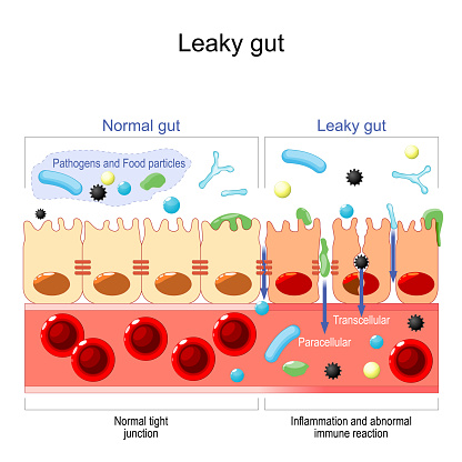 leaky gut. cells on gut lining held tightly together. in intestine with celiac disease and gluten sensitivity these tight junctions come apart. autoimmune disorder. Vector illustration