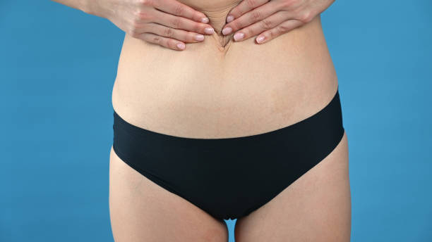 istock A woman pulls the skin on her stomach on blue background. Plastic surgery concept. 1316059722