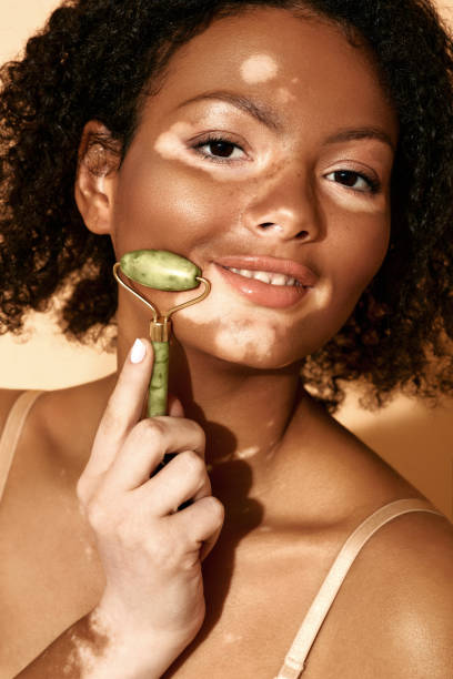istock Facial jade roller. Woman with vitiligo massages her face using a green jade roller for skin regeneration 1316077971