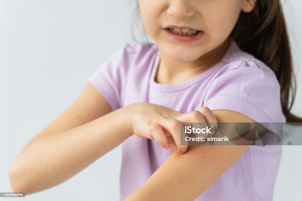 Scratching Midsection of an unrecognizable little girl is scratching her arm. Child Stock Photo