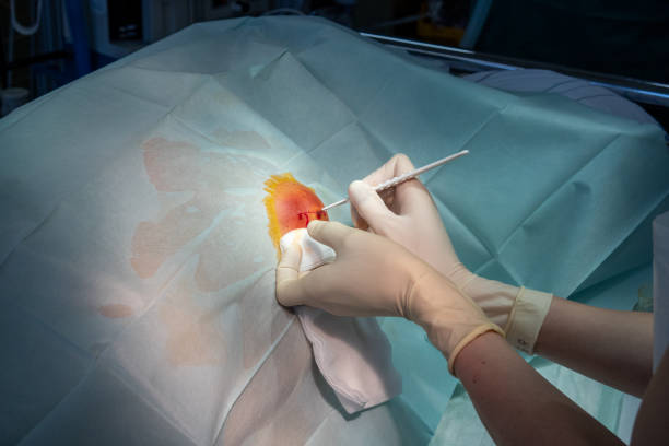 in the operating room the abscess of a patient is operated by a doctor in an operating room the abscess of a patient is operated by a doctor chest tattoo pain stock pictures, royalty-free photos & images