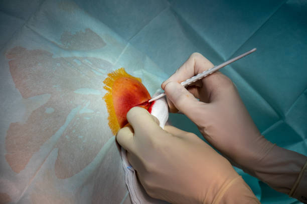 in the operating room the abscess of a patient is operated by a doctor in an operating room the abscess of a patient is operated by a doctor chest tattoo pain stock pictures, royalty-free photos & images