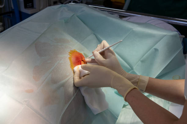 in the operating room the abscess of a patient is operated by a doctor in an operating room the abscess of a patient is operated by a doctor chest tattoo pain stock pictures, royalty-free photos & images
