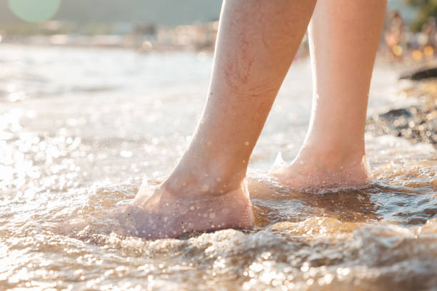 spataderen. een vrouw bevindt zich op het strand in het water en toont een vasculair netwerk op het lagere been. benenclose-up. het strand is op de achtergrond - woman legs veins stockfoto's en -beelden