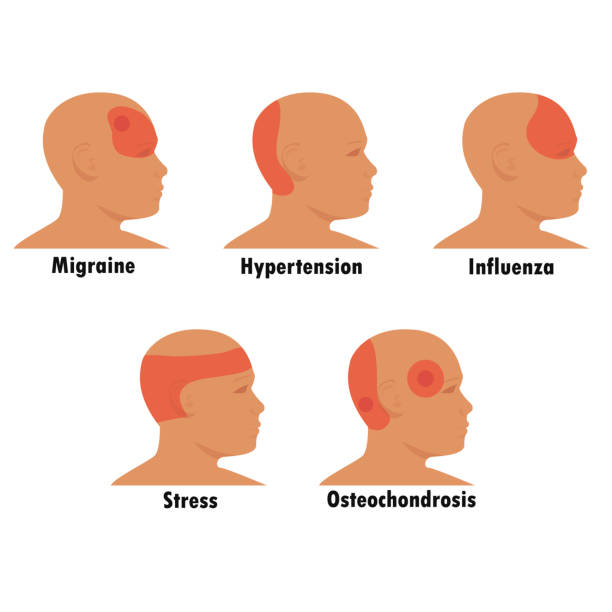 Types of headaches. Types of headaches. Schematic representation of foci of headache in stress, flu, osteochondrosis, hypertension. Migraine. Vector flat isolated on white background. headache stock illustrations