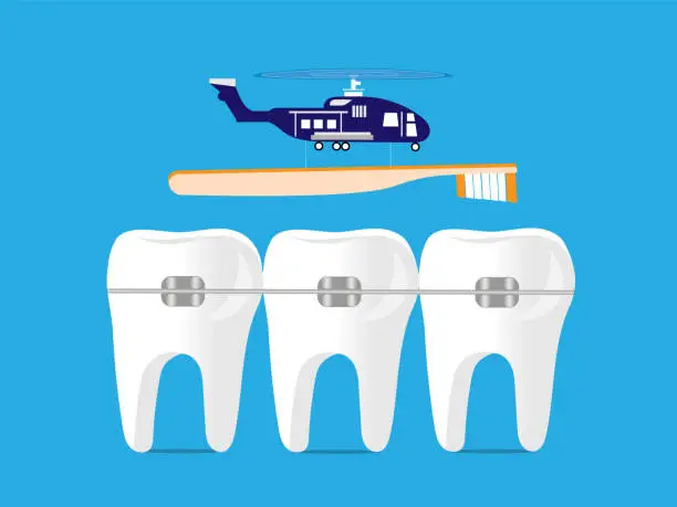 Vector illustration of Bringing toothbrush to braces