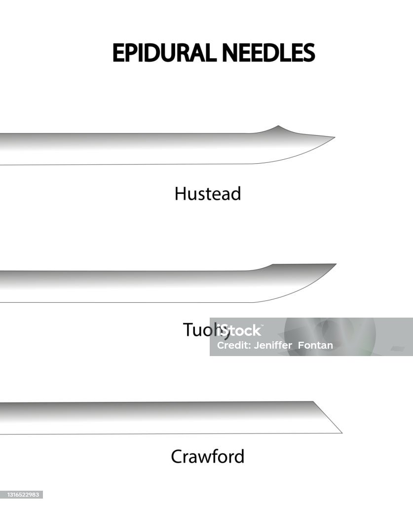 Epidural Needle. Different types of epidural needles side profile view. Anesthesiologist stock illustration Epidural Needle. Different types of epidural needles side profile view. Anesthesiologist stock illustration