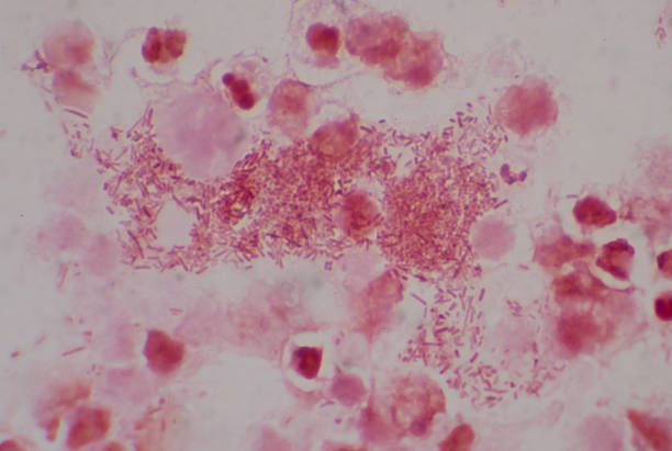 istock Moderate gram  nagative bacilli with white blood cells in urine sample. 1316575172