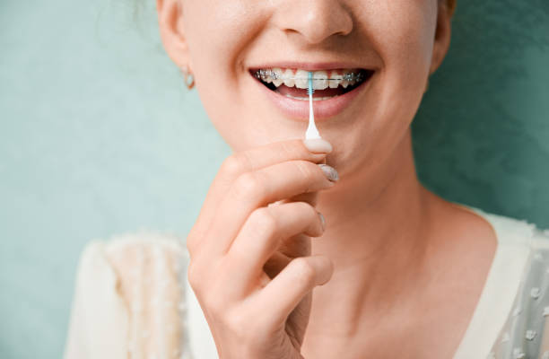 歯のフロスブラシを使用して歯にブレースを持つ若い女性. - floss toothpick ストックフォトと画像