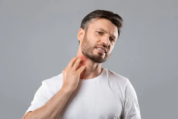 Middle aged bearded man scratching highlighted with red neck on grey studio background, copy space. Annoyed man suffering from itch, having rash on his neck. Allergic reaction, eczema concept