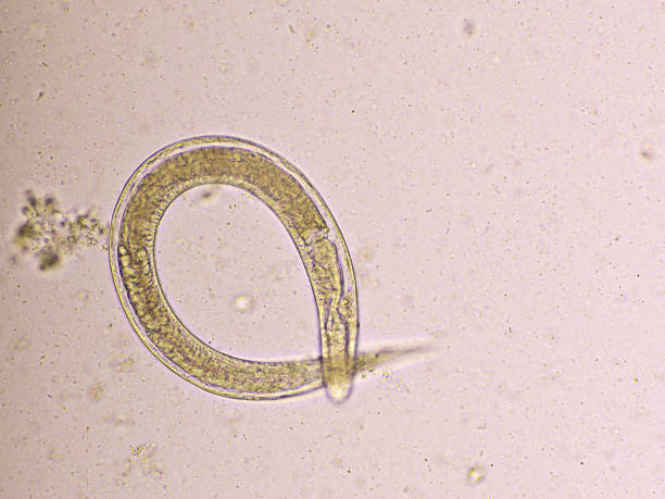 istock Strongyloides stercoralis or threadworm in human stool 1316644390