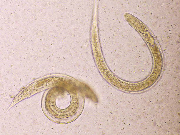 istock Strongyloides stercoralis or threadworm in human stool 1316644398