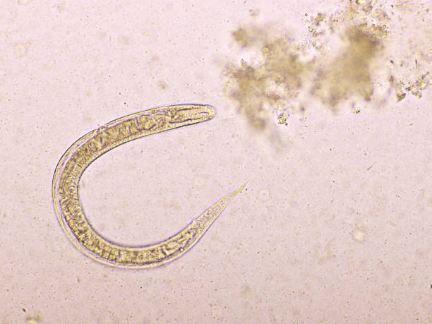 istock Strongyloides stercoralis or threadworm in human stool 1316644481
