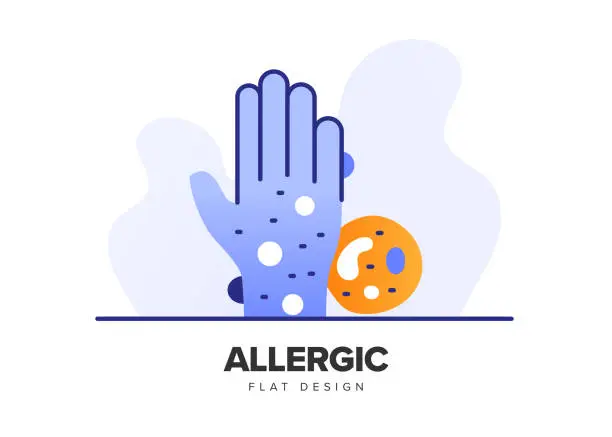 Vector illustration of Allergy Modern Flat Icon Concept Design