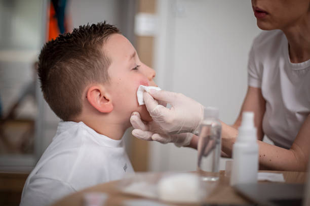 istock Mother cleaning her son's wound on his cheek 1316691244