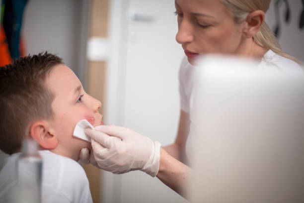 istock Mother cleaning her son's wound on his cheek 1316692147