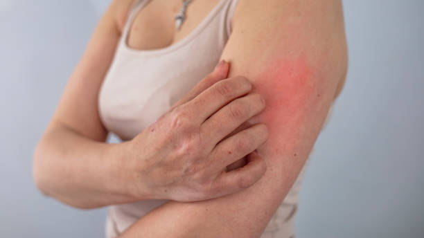 istock Women scratch the itch with hand 1316734059