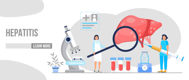 Hepatology concept vector for medical website, landing page. Concept of hepatitis A, B, C, D, cirrhosis, world hepatitis day. Tiny doctors treat liver. Hepatology concept vector for medical website, landing page. Concept of hepatitis A, B, C, D, cirrhosis, world hepatitis day. Tiny doctors treat the liver. hepatitis stock illustrations