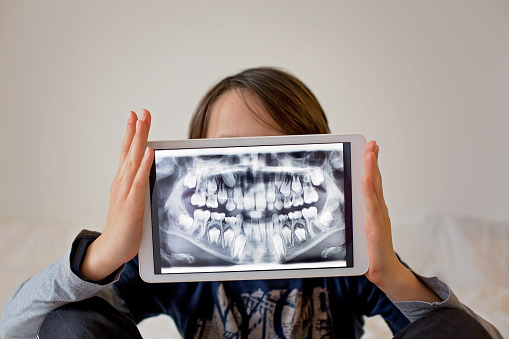 Child, preteen boy, holding tablet with a picture of his x-ray teeth from the dentist