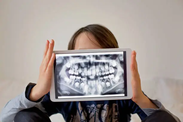 Photo of Child, preteen boy, holding tablet with a picture of his x-ray teeth