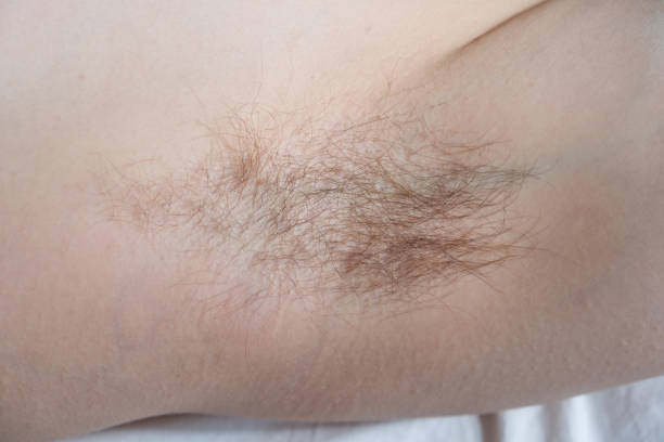 istock Female hairy armpit close up, body positive 1316772406