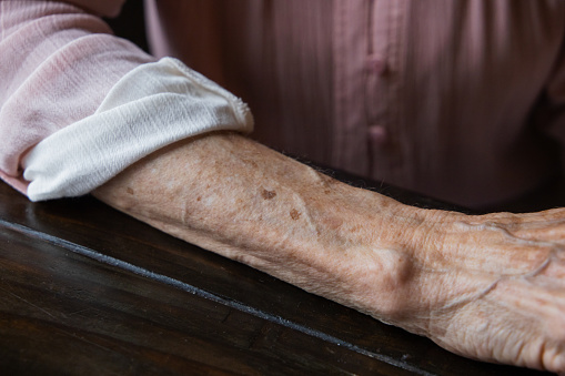 Anf elderly woman grandmother's arm with wrinkles and age spots and her sleeve rolled up.