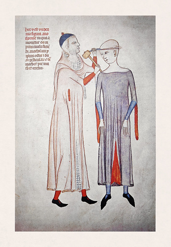 Surgeon performing trepanation on a patient in the 14th century produced by an unknown artist.