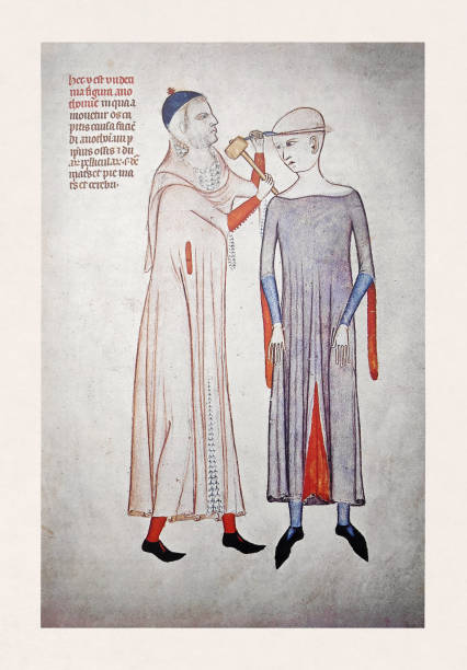 14th century surgeon performing trepanation Surgeon performing trepanation on a patient in the 14th century produced by an unknown artist. circa 14th century stock illustrations