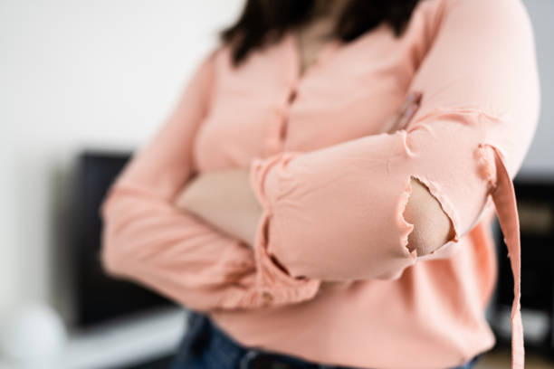 istock Clothing Hole. Torn And Damaged Clothes 1316931847