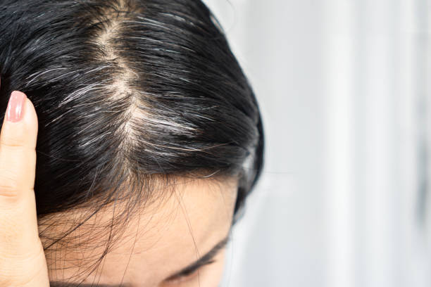 istock Asian woman having problem with grey, white hair growing up 1317093153
