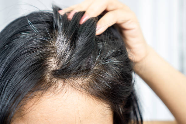 istock Asian woman having problem with grey, white hair growing up 1317093220