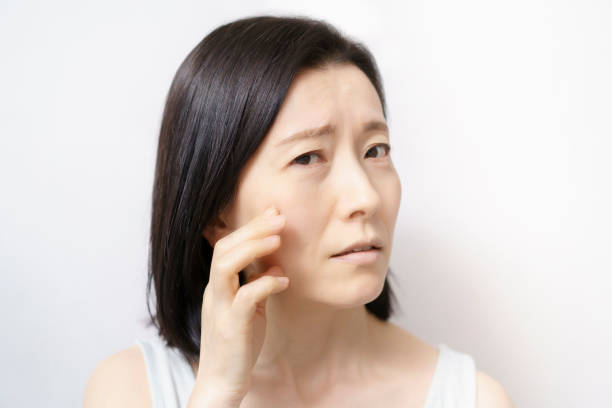 istock Middle-aged woman suffering from skin problems 1317368062