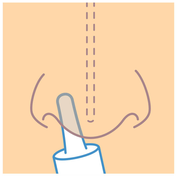 Front view inserting nasal spray Nasal spray tube pointing away from the septum septum stock illustrations