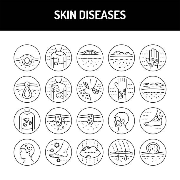 ilustraciones, imágenes clip art, dibujos animados e iconos de stock de se establecen iconos de línea de enfermedades de la piel. elemento vectorial aislado. - dermatología