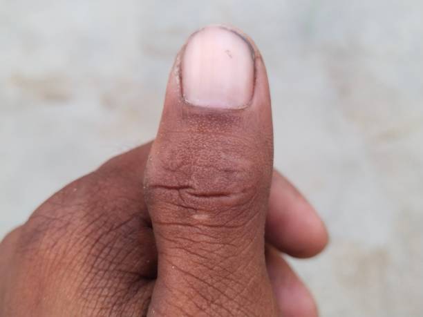 istock Body parts hand 1317608632