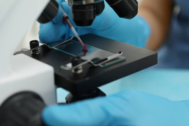 Doctor with blood sample from finger at table in laboratory, closeup Doctor with blood sample from finger at table in laboratory, closeup diabetes epidemiology stock pictures, royalty-free photos & images